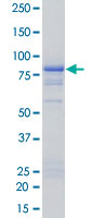 SDS-PAGE Stained with Coomassie Blue